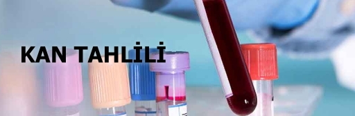 Kan Tahlili Nedir? Neden Yaplr?