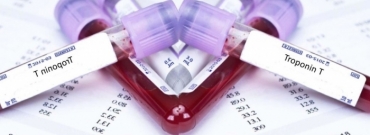 Troponin testi nedir? neden yaplr?