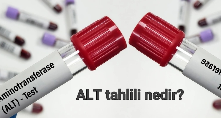 ALT tahlili nedir?
