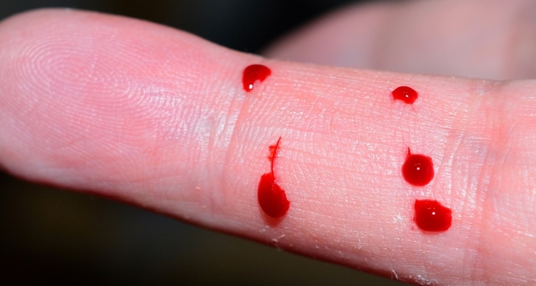 Hemofili Hastal Nedir?