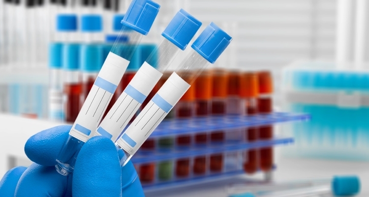 Hemogram (Tam Kan Saym) Nedir?