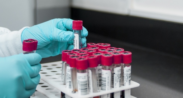 Troponin testi nedir? neden yaplr?